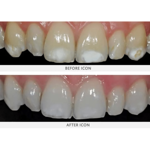 Stains San Marcos Kids Dentistry in San Marcos, CA